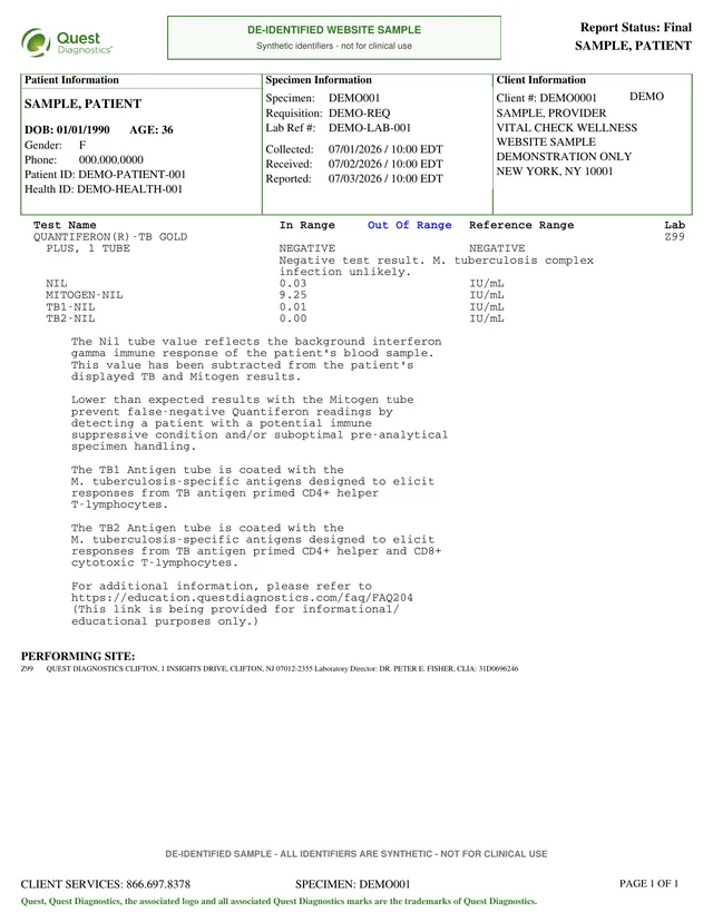Synthetic Quest QuantiFERON laboratory result included behind the HHA health assessment report